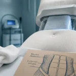 Cryolipolyse pour enlever la graisse du ventre sans chirurgie, ventre et appareil froid