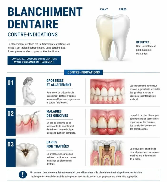 Infographie sur les contre-indications et risques du blanchiment dentaire